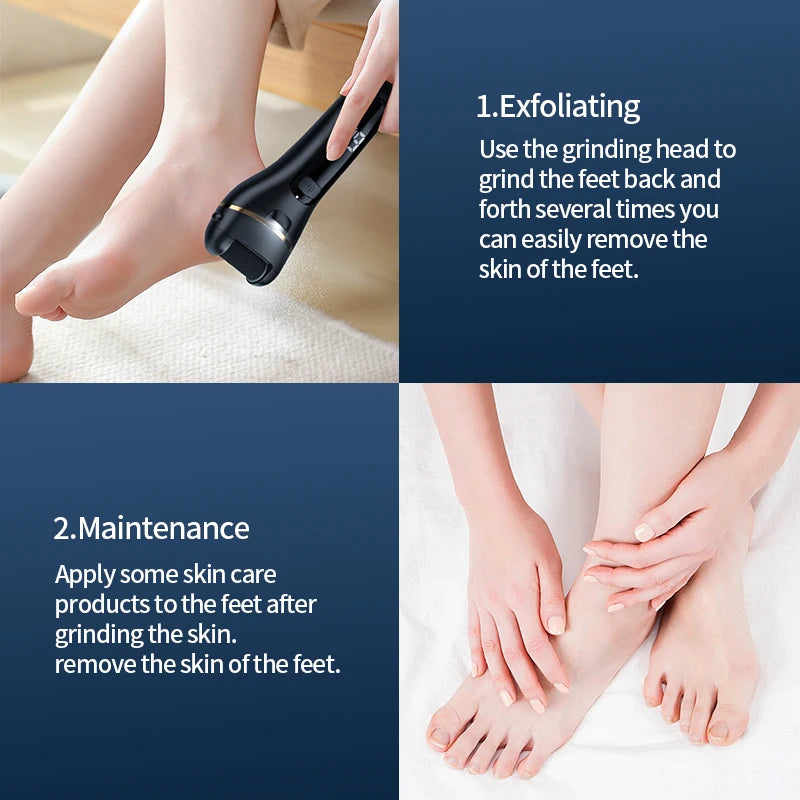 SmoothStep Callus Remover