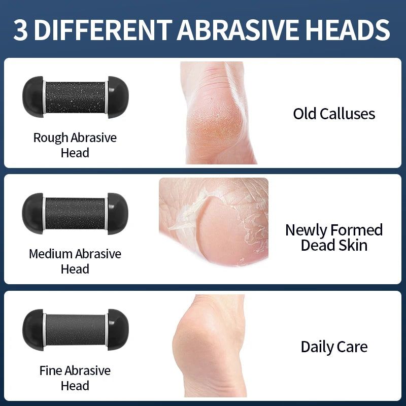 SmoothStep Callus Remover